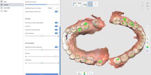 escaner-dental-TA-odontología-digital